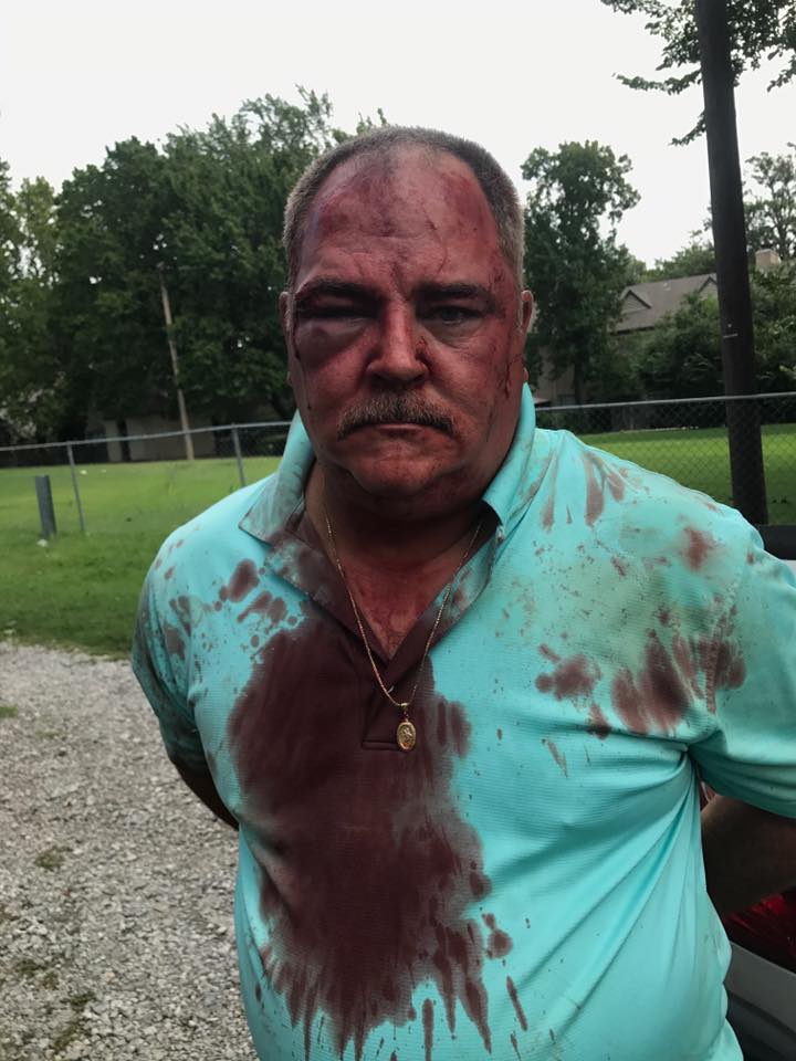 Family of man injured in altercation with police say ...